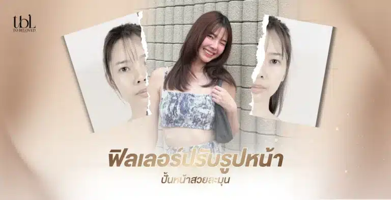 ฟิลเลอร์ปรับรูปหน้า