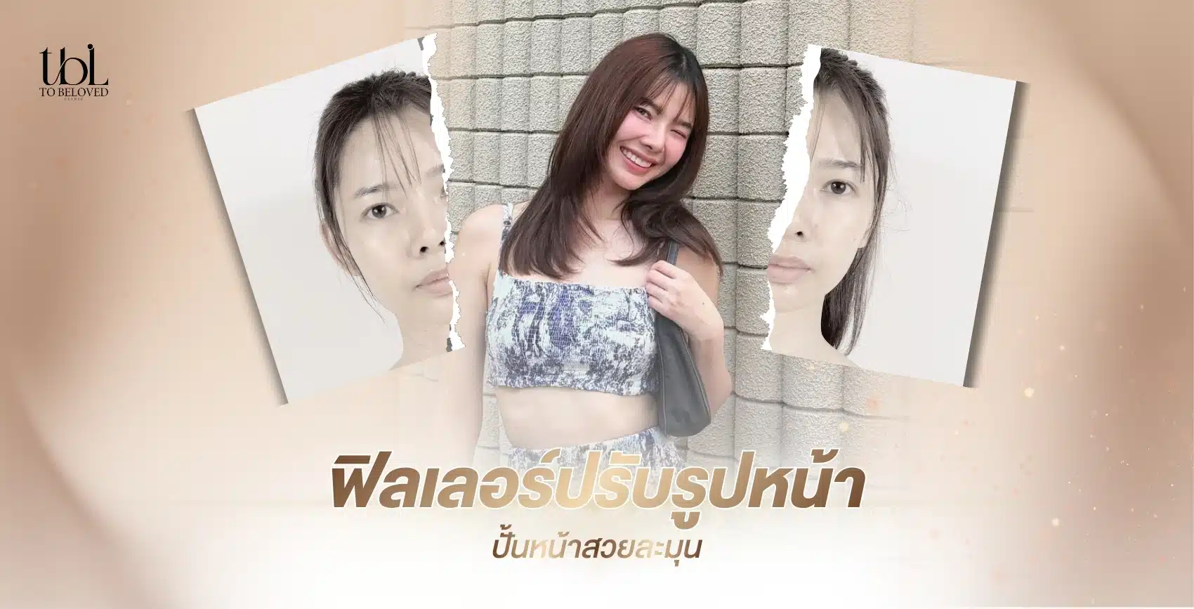 ฟิลเลอร์ปรับรูปหน้า