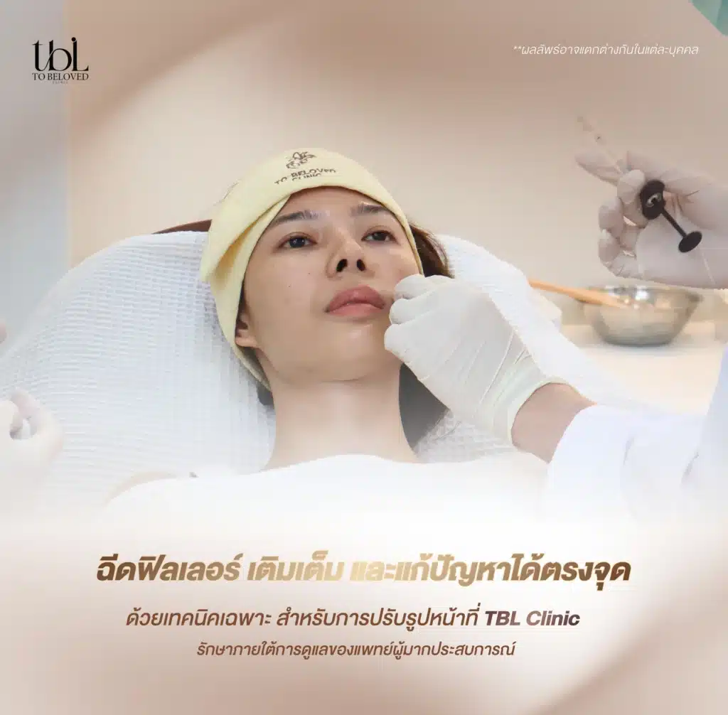 ฟิลเลอร์ปรับรูปหน้า