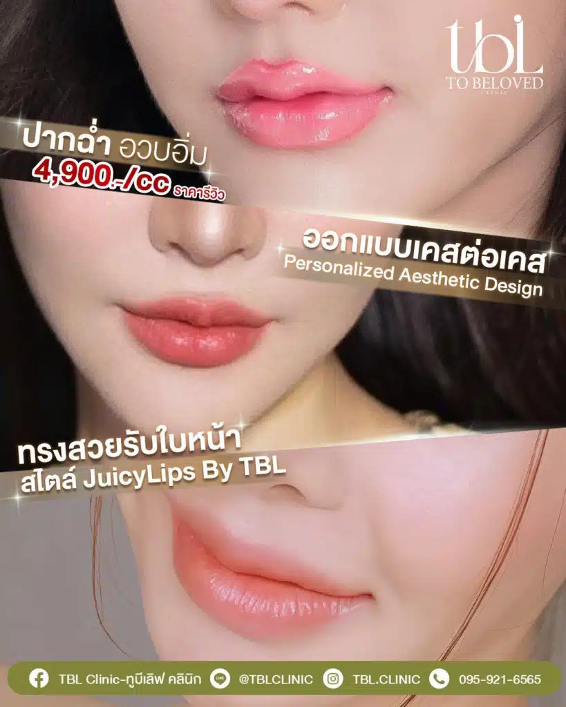 ฟิลเลอร์ปาก