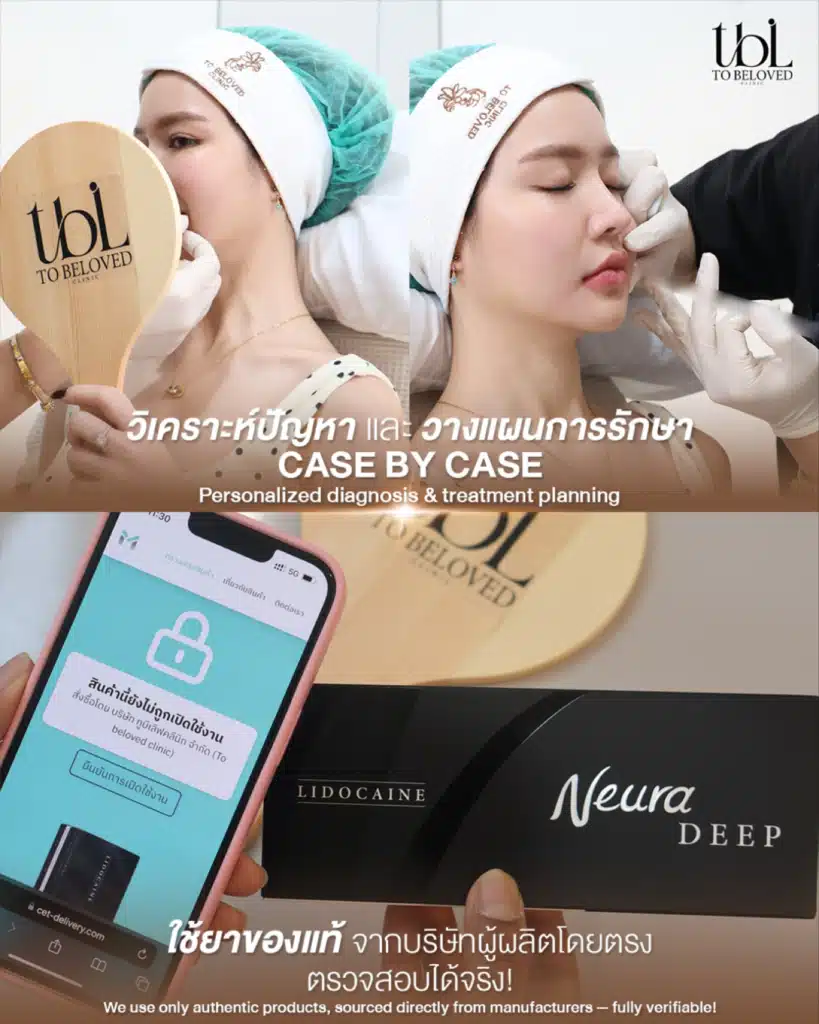 ฟิลเลอร์ปาก