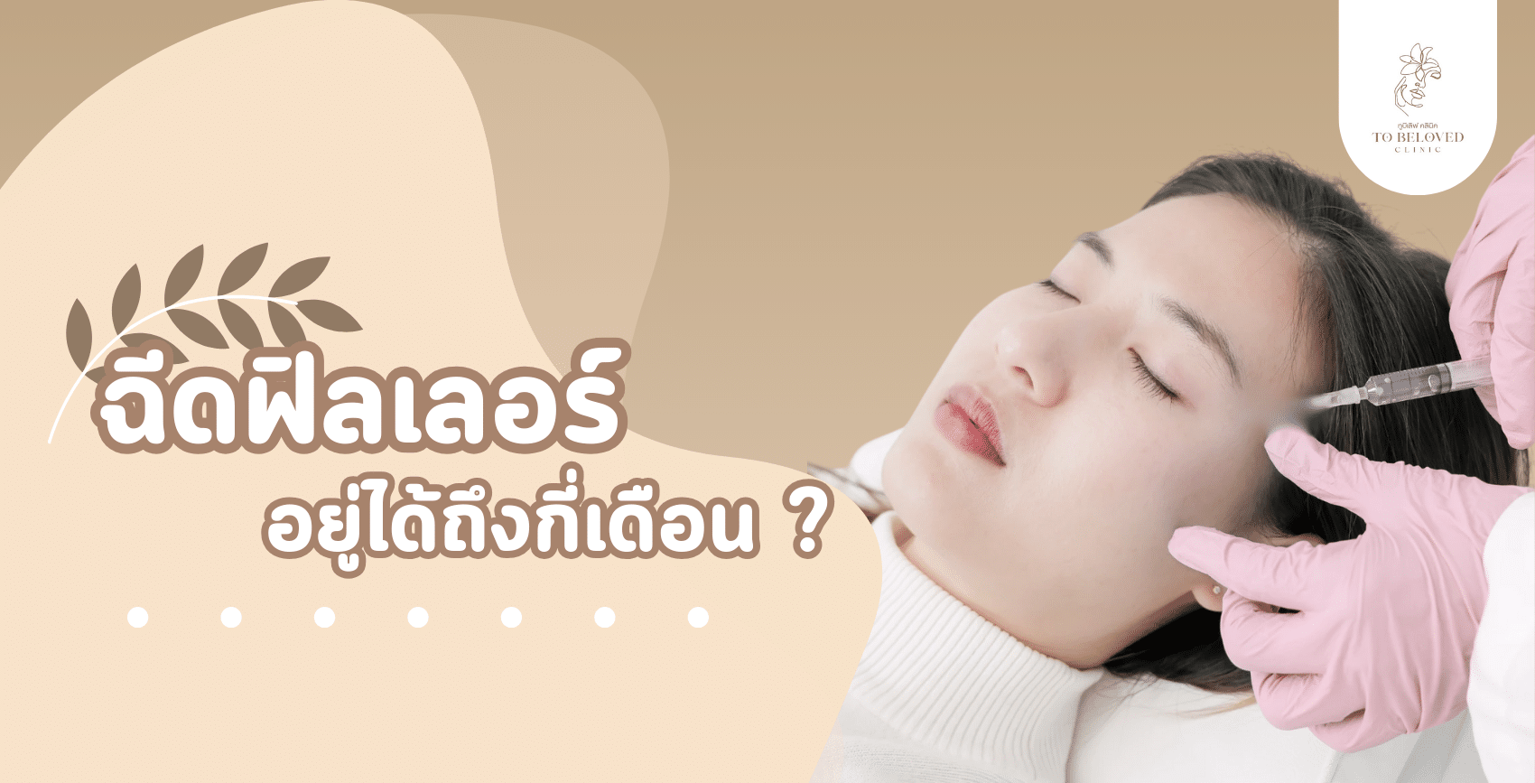 How long do fillers last?