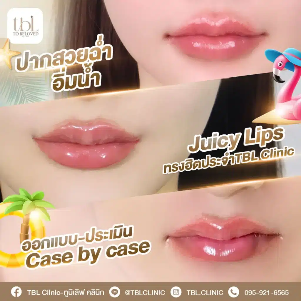 ฉีดฟิลเลอร์ปากทรงไหนดี