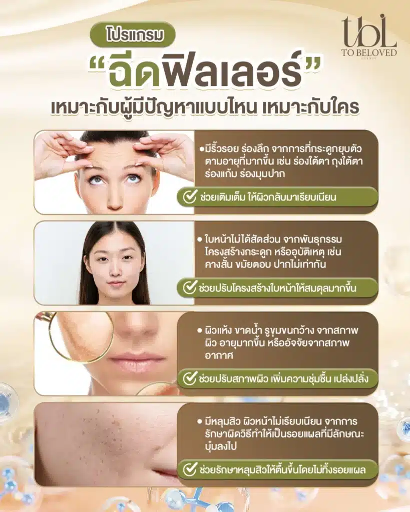 ฟิลเลอร์