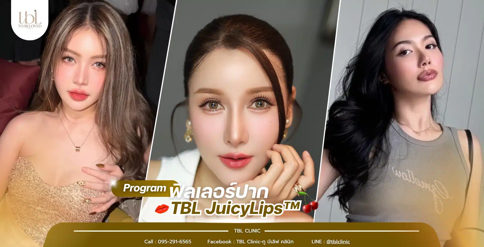 ฟิลเลอร์ปาก