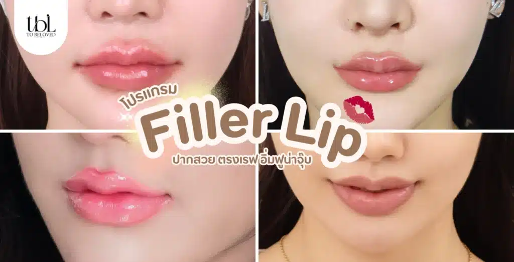 ฉีดฟิลเลอร์ปาก