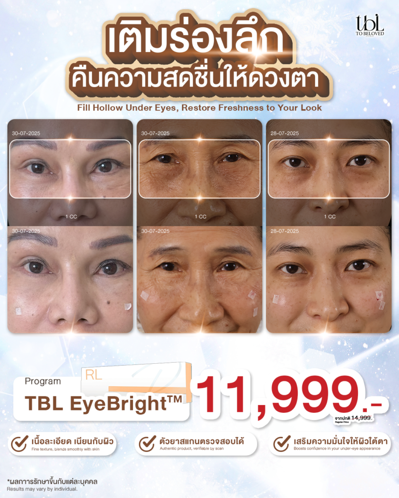 ฟิลเลอร์