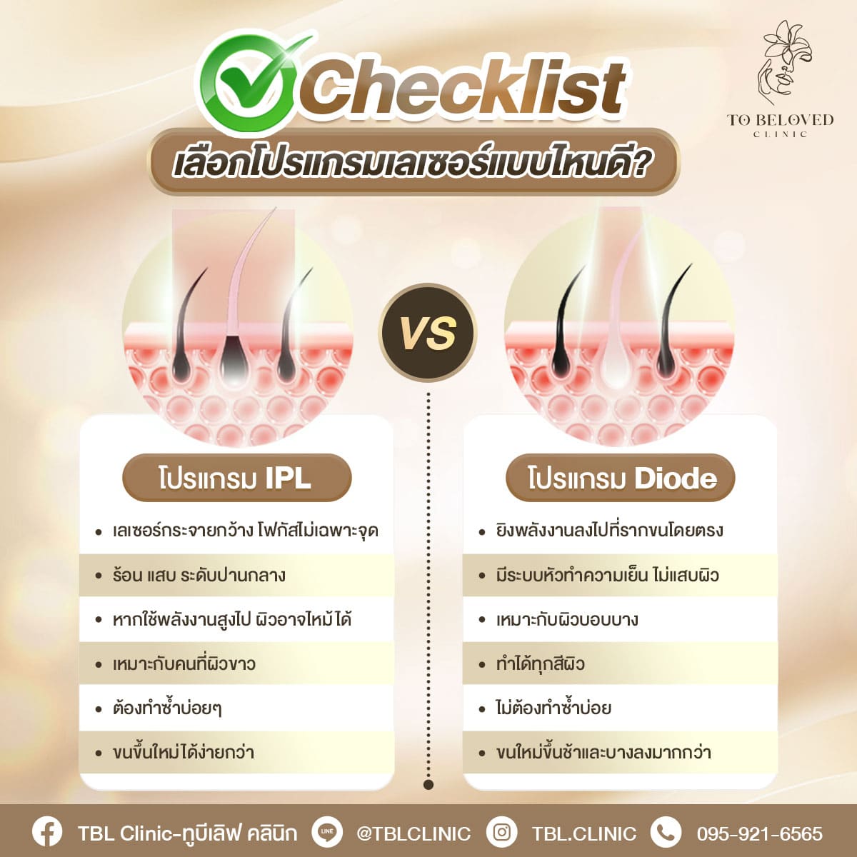 Diode laser vs ILP