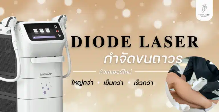 Diode laser ทำงานยังไง
