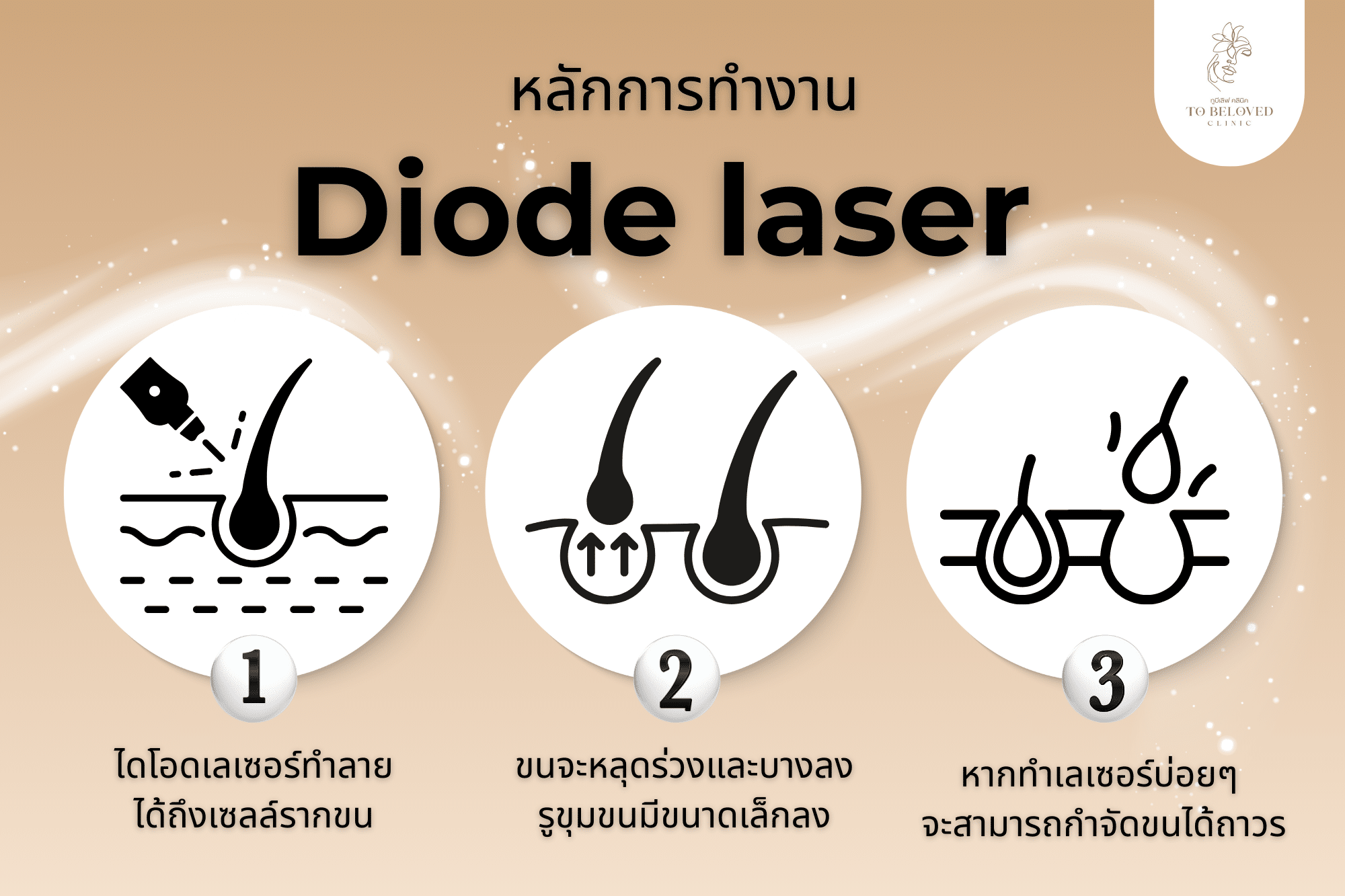 หลักการทำงานของ Diode laser