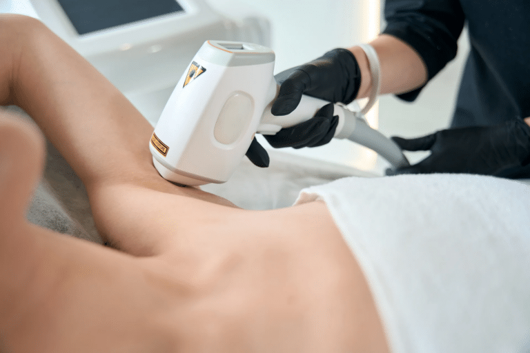 YAG Laser