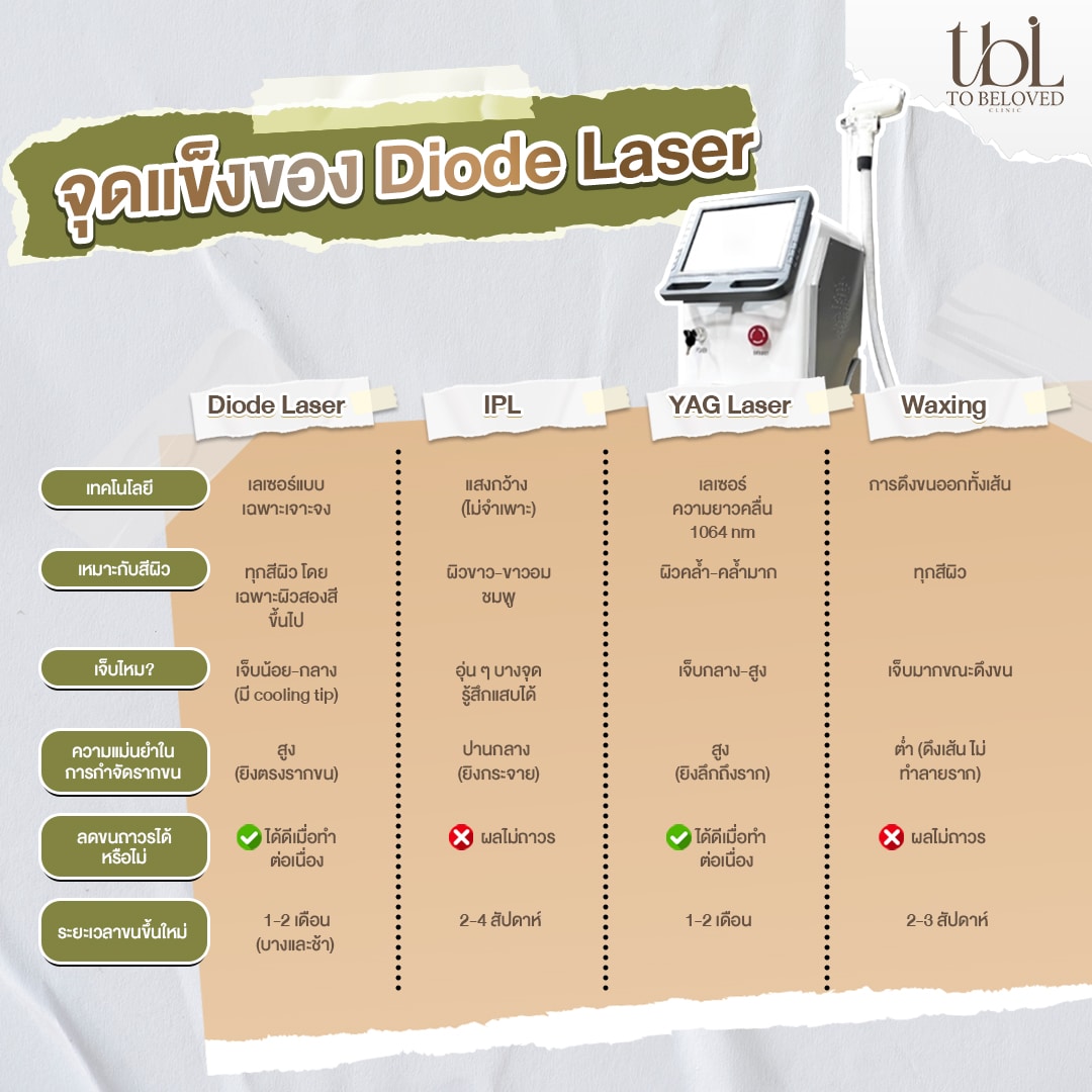 diode laser