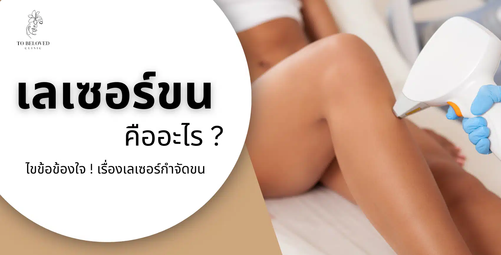 เลเซอร์ขนคืออะไร