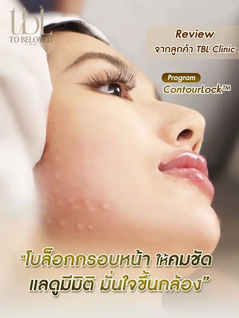 โบท็อกลิฟกรอบหน้า