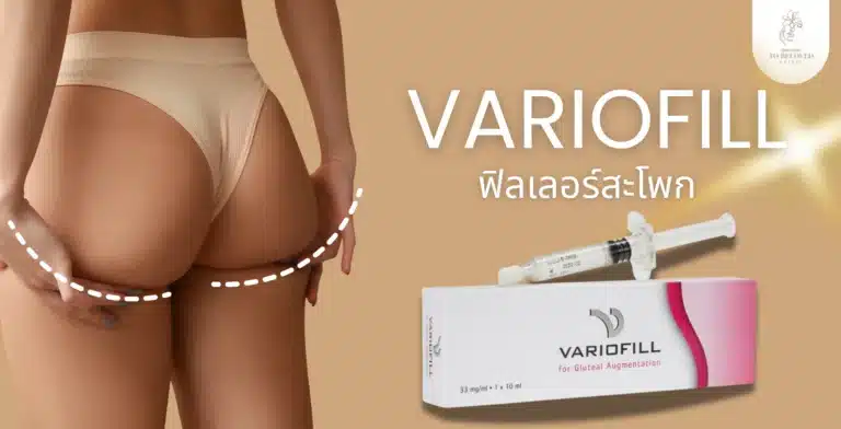 Variofill