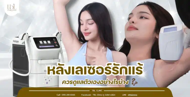 หลังเลเซอร์รักแร้