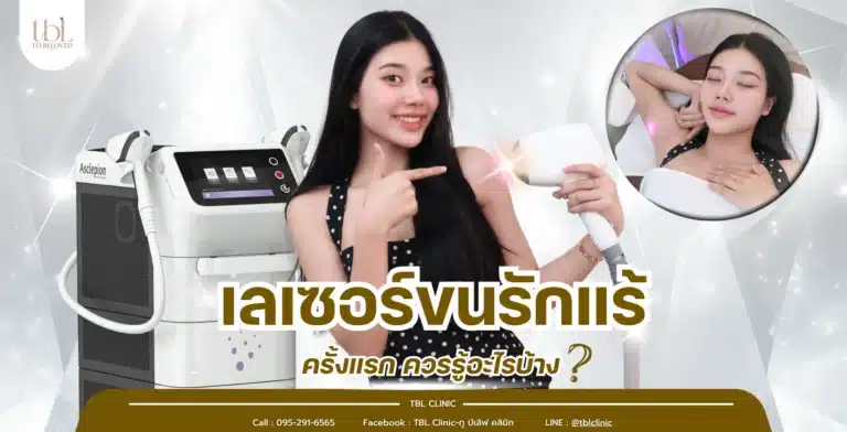 เลเซอร์ขนรักแร้