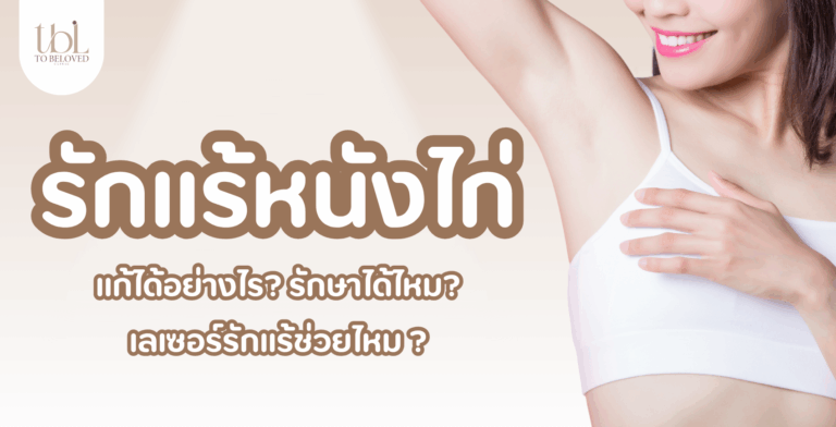 รักแร้หนังไก่