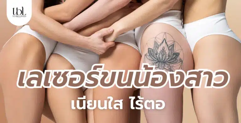 เลเซอร์ขนน้องสาว