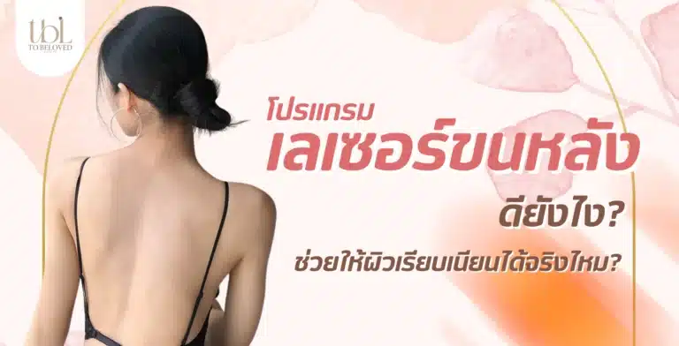 เลเซอร์ขนหลัง
