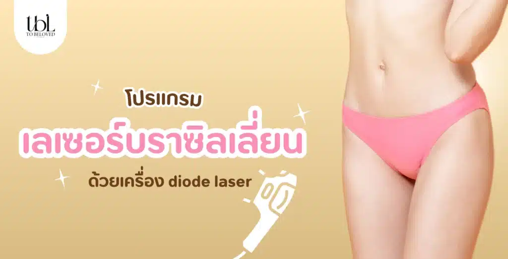เลเซอร์บราซิลเลี่ยน