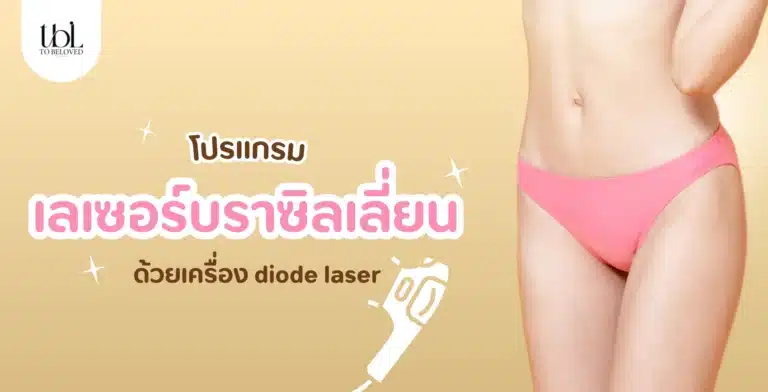เลเซอร์บราซิลเลี่ยน