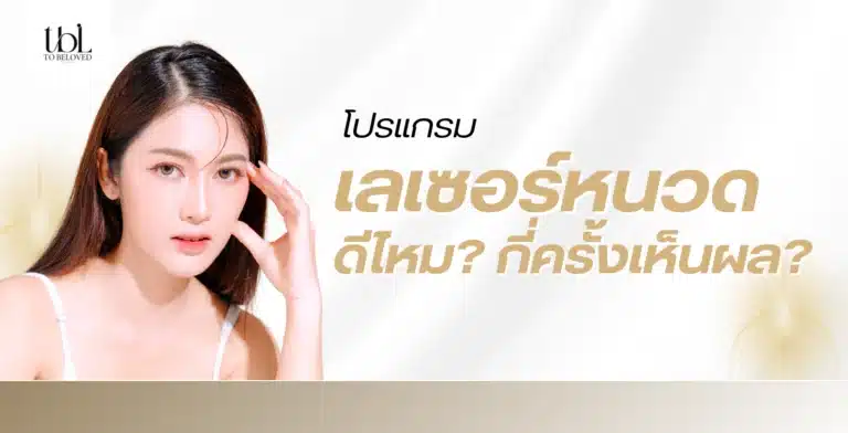 เลเซอร์หนวด