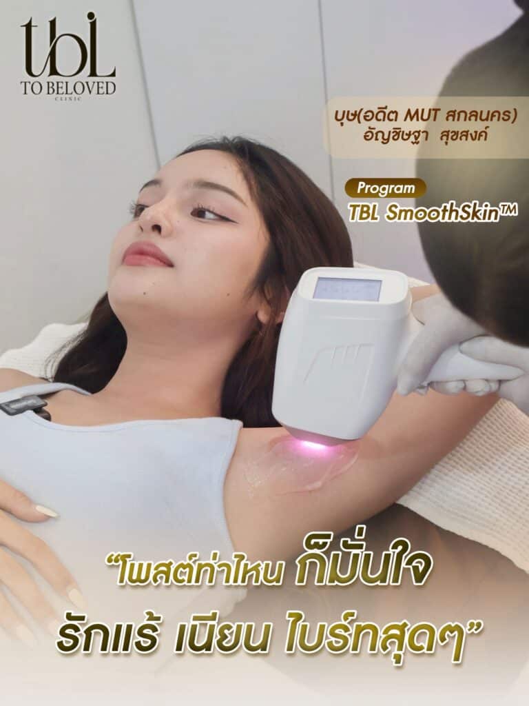 รีวิวเลเซอร์รักแร้