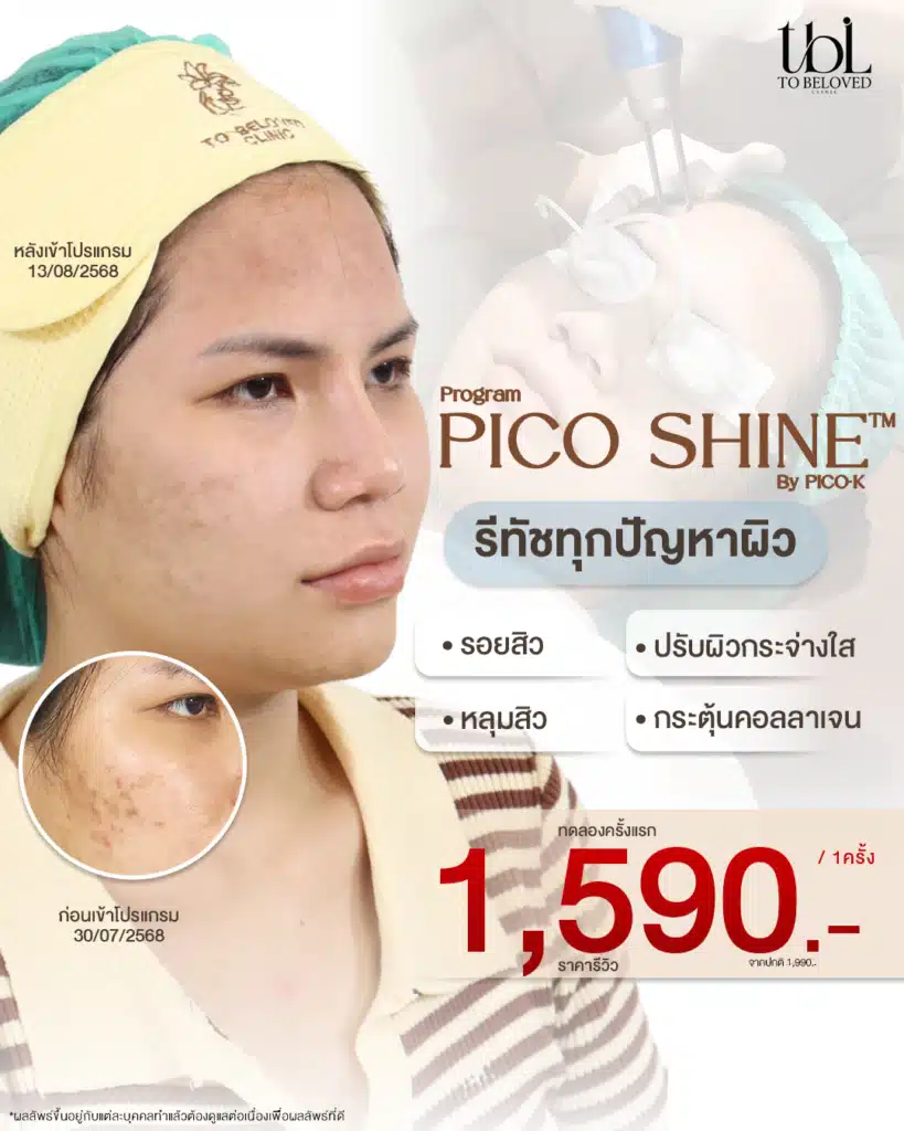Pico Laser ราคา