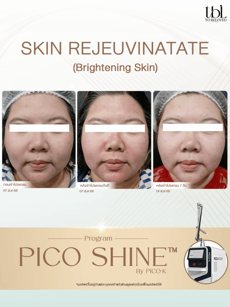 รีวิว Pico K