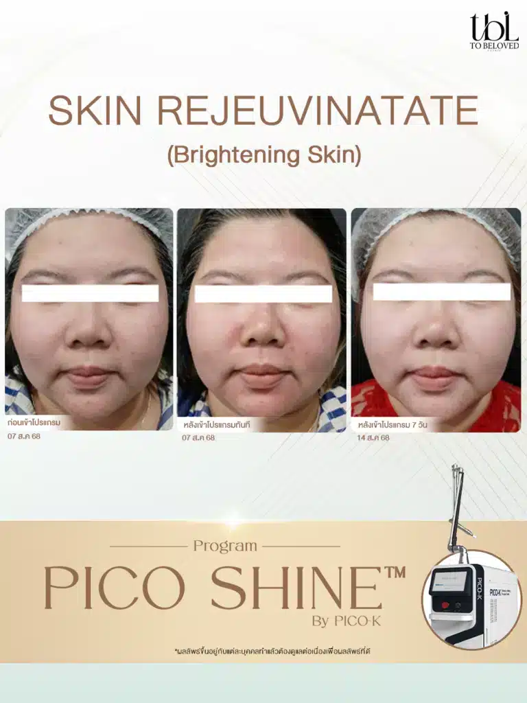 รีวิว Pico K