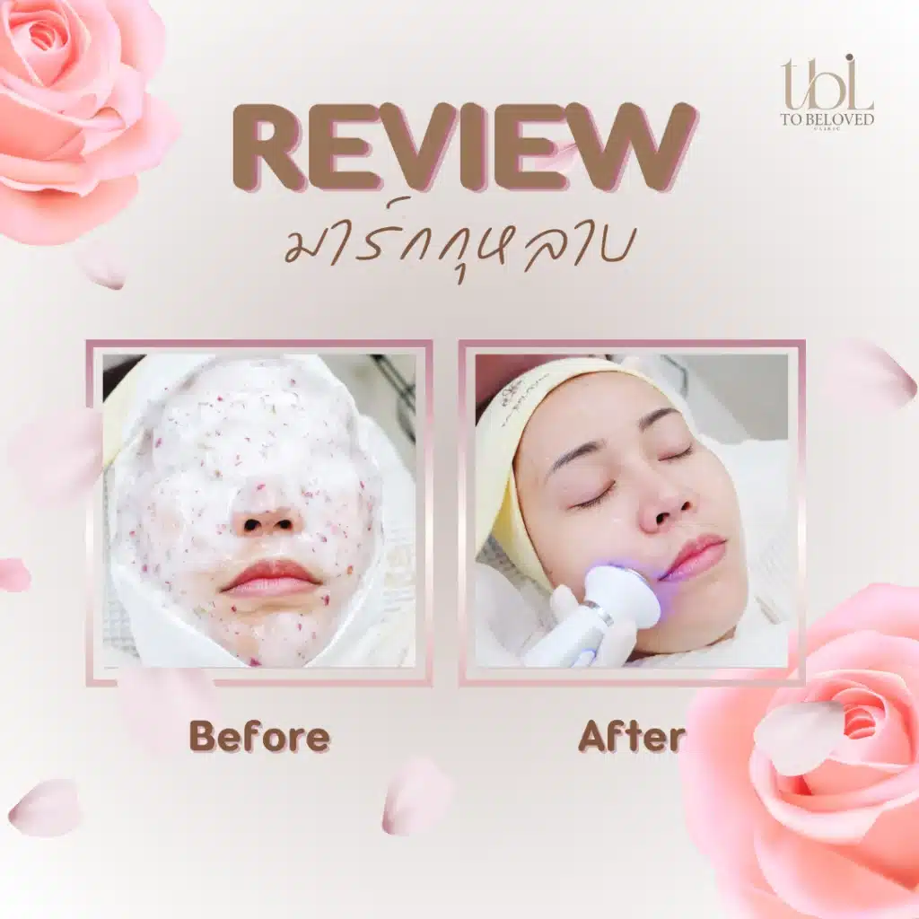 รีวิวมาร์กกุหลาบ