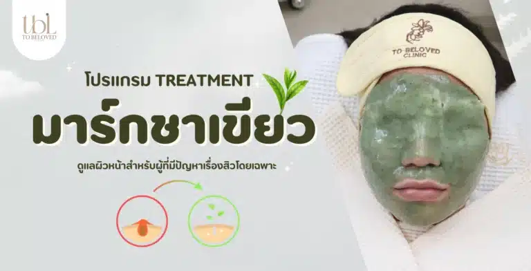 Treatment มาร์คชาเขียว