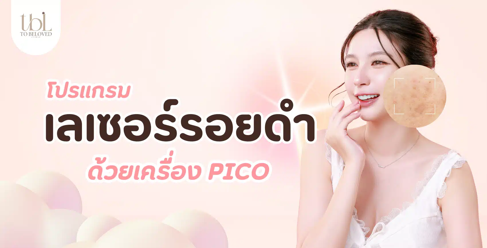 เลเซอร์รอยดำ เลเซอร์รอยดำ