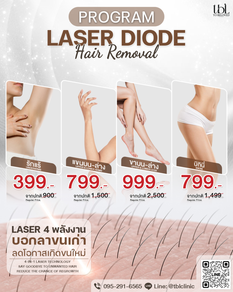 เลเซอร์ขน