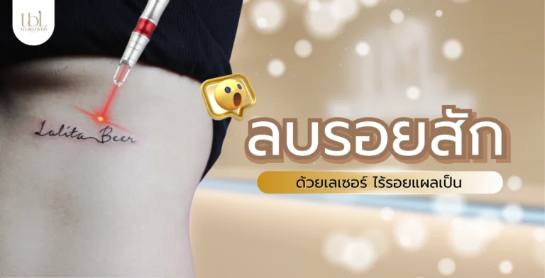 ลบรอยสัก