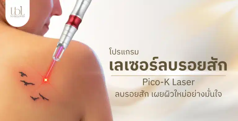 เลเซอร์ลบรอยสัก