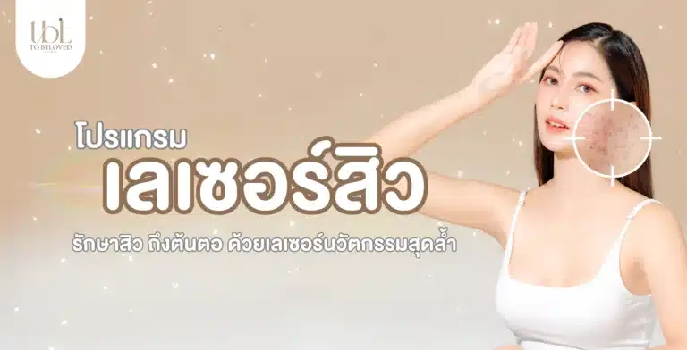 เลเซอร์สิว