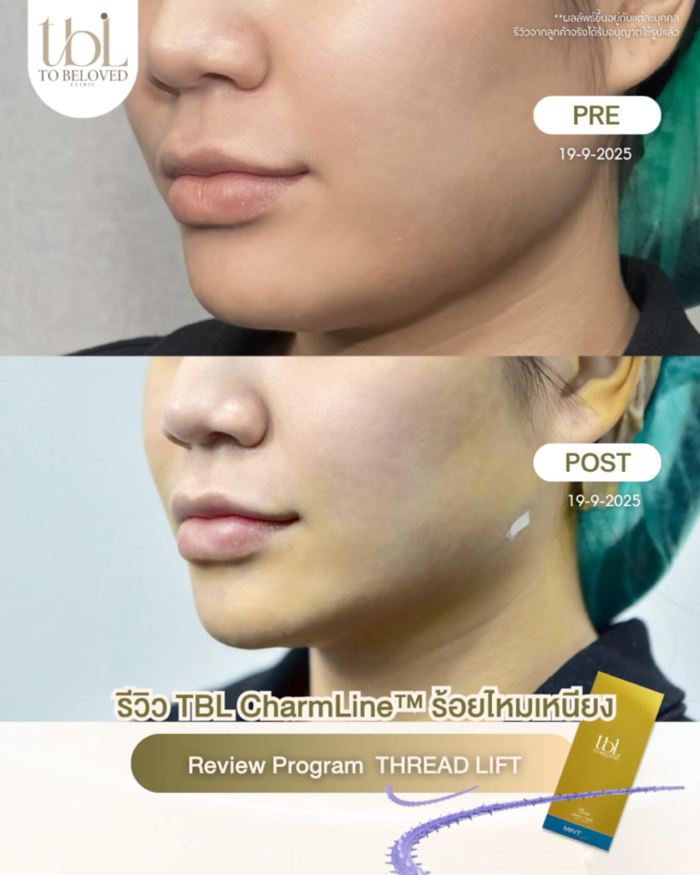 รีวิวร้อยไหม