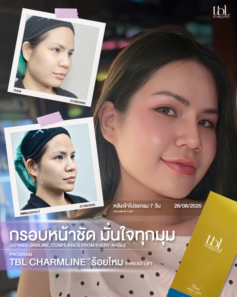 รีวิวร้อยไหม