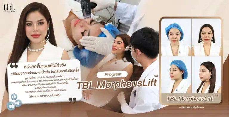 รีวิว Morpheus8