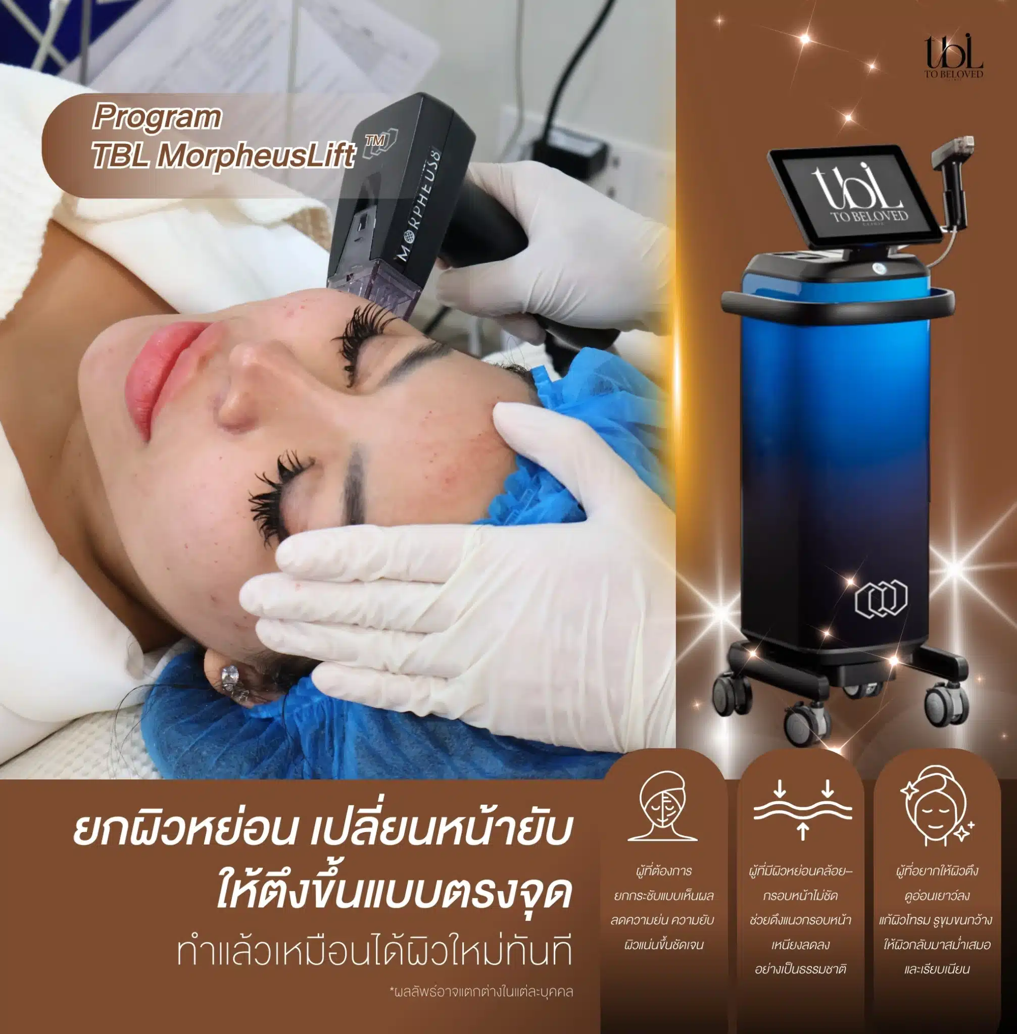 รีวิว Morpheus8