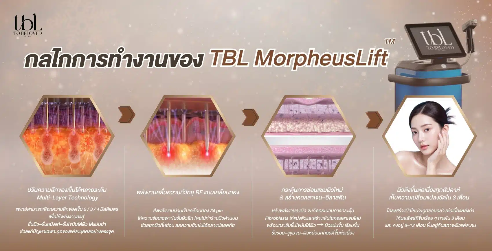 รีวิว Morpheus8