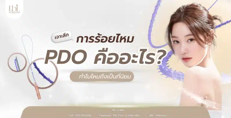 ร้อยไหม pdo