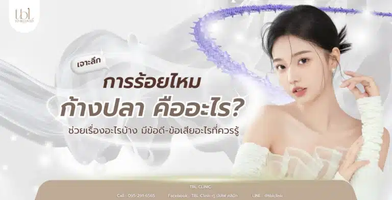 ร้อยไหมก้างปลา