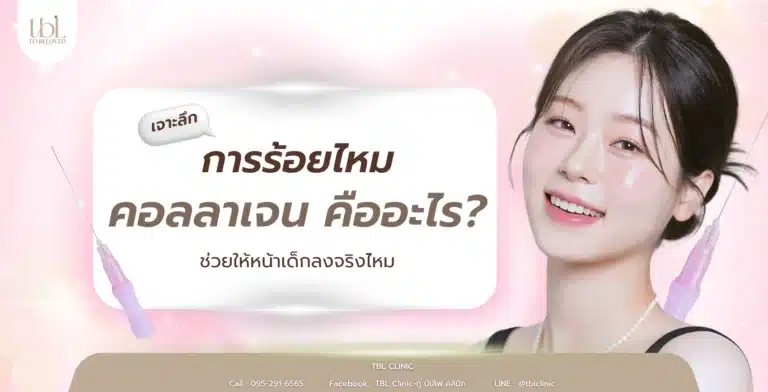 ร้อยไหมคอลลาเจน