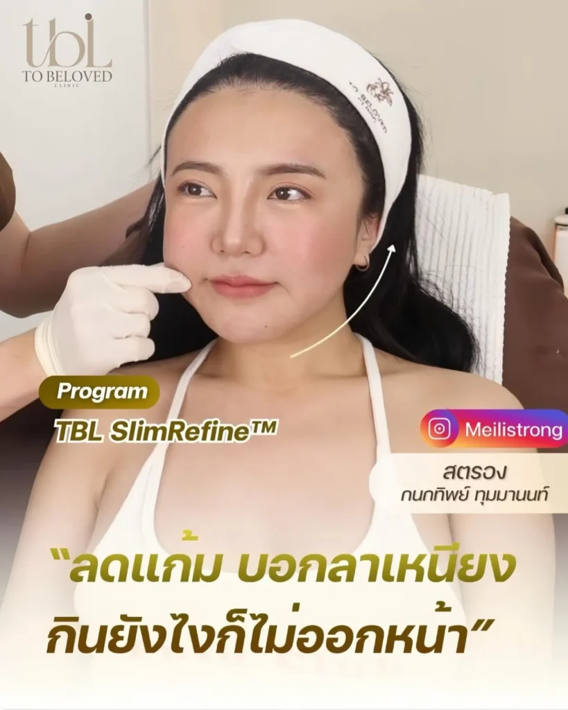 ฉีดแฟต