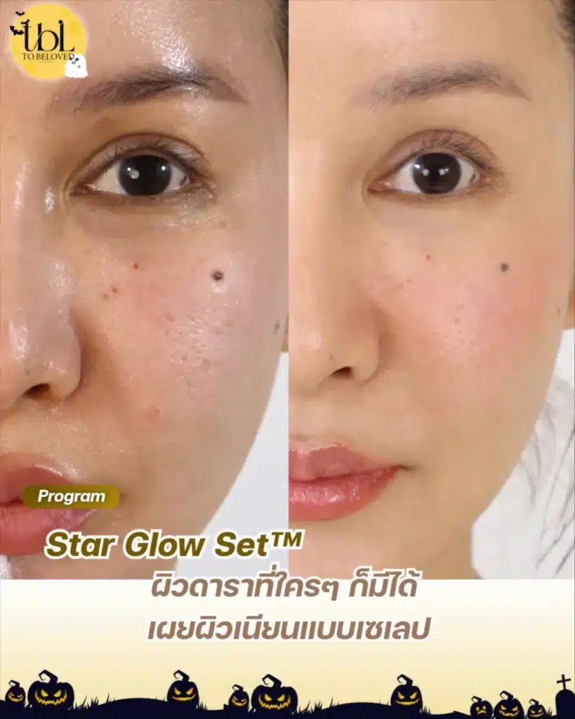 เซตผิวดารา