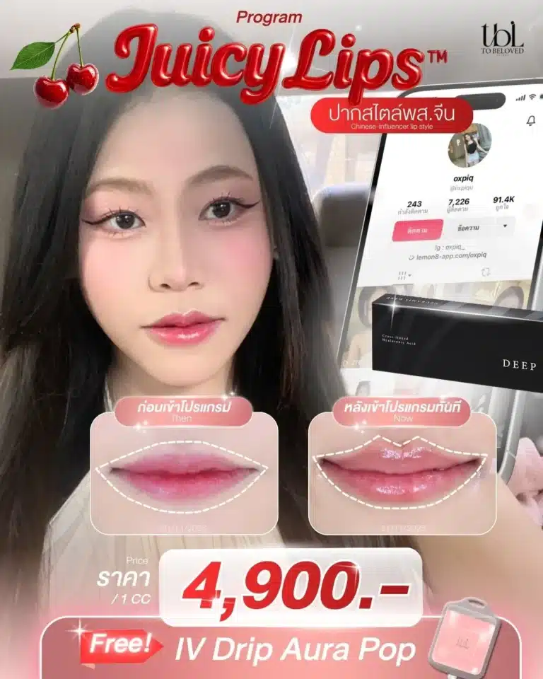 โปรปากแมว