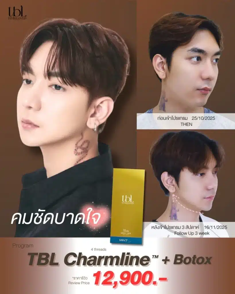 ร้อยไหมเหนียง